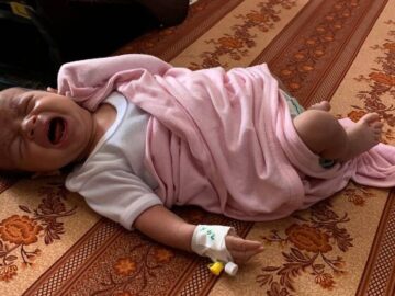 افزایش بی‌سابقه موارد فلج عضلانی حاد در غزه