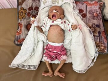 شهادت نوزاد ۶ ماهه فلسطینی بر اثر شدت گرسنگی