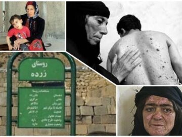 هیروشیمای ایران هنوز می‌سوزد؛ زرده، بایگانیِ دردهای خاموش