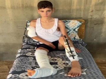 «احمد العبادله»؛ کودکی که جنگ و مورچه‌ها در چادر مرگ او را می‌بلعند
