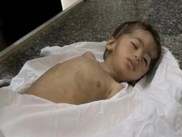 جان باختن ۷ نفر دیگر از جمله یک کودک بر اثر گرسنگی در غزه