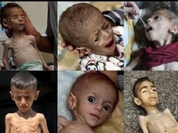 گزارش مدیر امداد پزشکی غزه از وخامت اوضاع بهداشتی