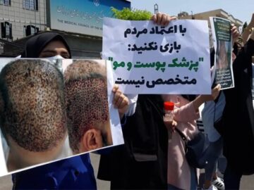 هزینه‌ای فراتر از پول؛ پشت پرده کاشت موهای ناموفق در مراکز غیرمجاز