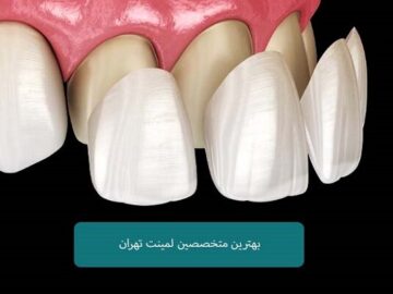 اسامی متخصصین لمینت دندان تهران