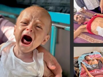 اذعان «هاآرتص» به فجایع غزه؛ همه جا را گرسنگی فراگرفته است+ تصاویر