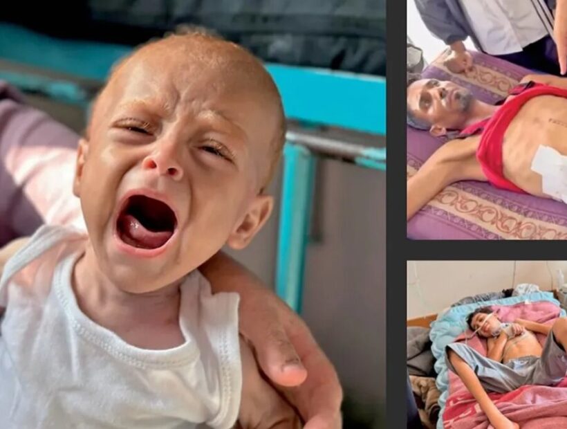 اذعان «هاآرتص» به فجایع غزه؛ همه جا را گرسنگی فراگرفته است+ تصاویر