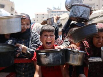 شهادت ۳۳۰ نفر در غزه بر اثر گرسنگی و سوء تغذیه