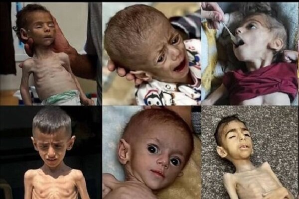 غزه زیر آتش و گرسنگی؛ صف‌های غذا به قربانگاه تبدیل می‌شوند