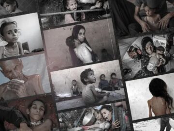 شیوع ویروس کشنده در غزه که کودکان گرسنه را قربانی می‌کند