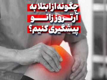 چگونه از ابتلا به آرتروز زانو پیشگیری کنیم؟